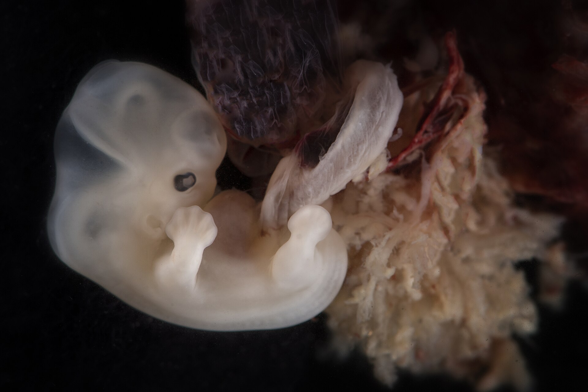 human embryo, about six weeks